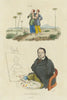 BIOLOGY. Anomalies Humaines (Human Abnormalities) 1833 old antique print