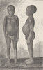 GABON. Akkas (A Dwarf tribe of Central Africa)  1891 old antique print picture