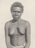 AUSTRALIA. Australia. Cicatrization; custom of making scars on the body 1900