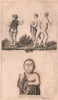 MEDICINE. Siamese twins. Genetic deformities. BUFFON 1837 old antique print