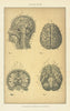 Human Brain. Anatomy 1907 old antique vintage print picture