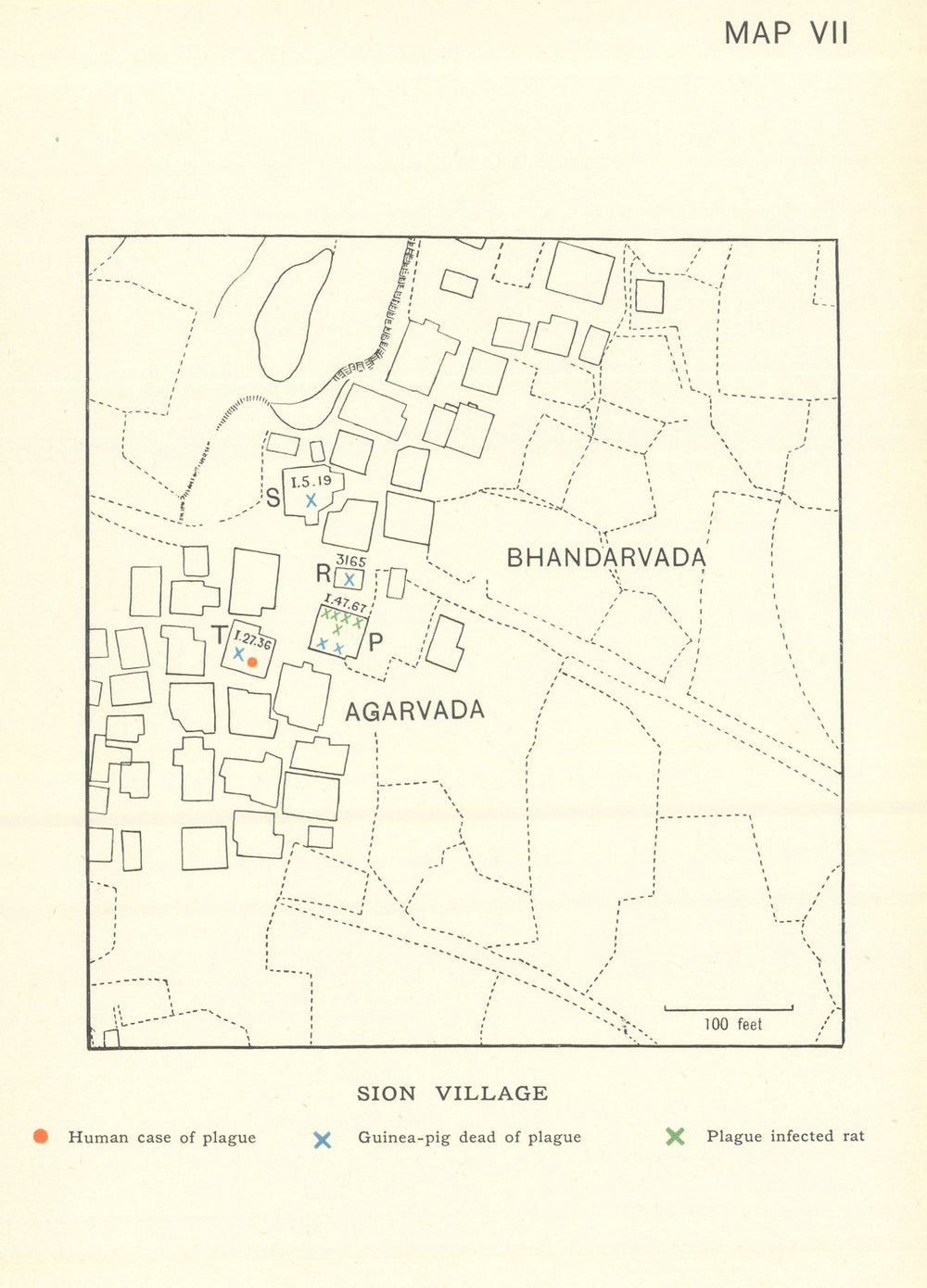 3rd Plague Pandemic—Mumbai—Bombay—Sion Village—Bhandarwada—Agarwada—dot map 1911