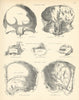 Anatomy. Frontal Bone. Ethmoid Bone. Parietal Bone 1880 old antique print