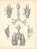 Anatomy. Larynx Muscles & Cartilages, Lungs, Heart 1880 old antique print