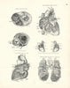 Anatomy. Heart Horizontal Section, Right & Left Chambers, Pulmonary Artery 1880