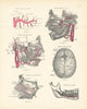 Anatomy. Internal Maxillary, Dura Mater, Nasal, Inferior Dental Arteries 1880
