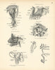 Anatomy. Orbital Nerves, Superior Maxillary Nerve, Spheno-Palatine Ganglion 1880