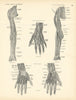 Anatomy. Cutaneous Nerves of Upper Extremity & Hand 1880 old antique print