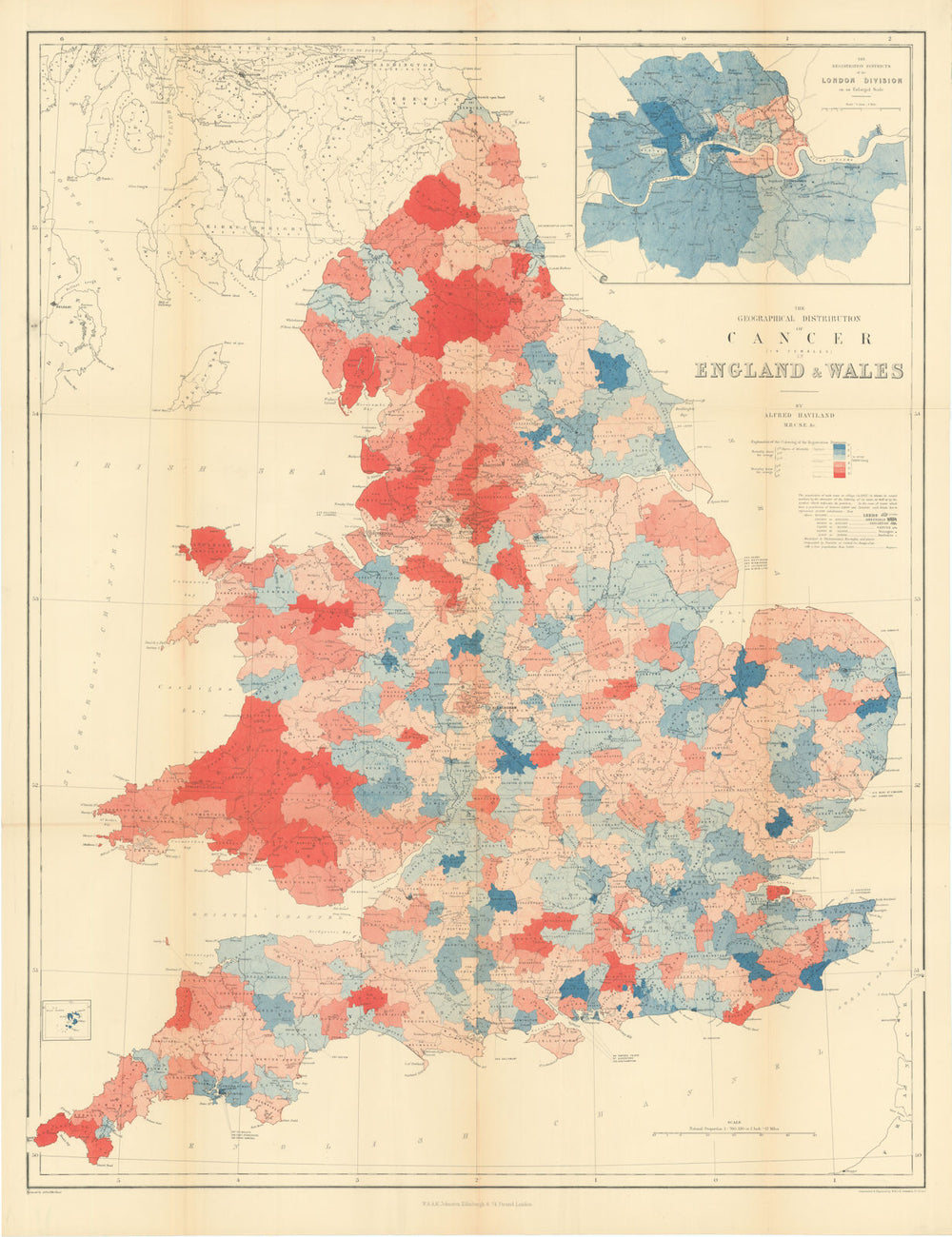 Female cancer mortality—England & Wales—Alfred Haviland choropleth map 1875